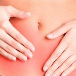 Endometriosis